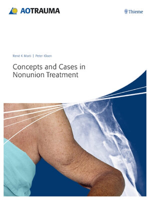 cover image of Concepts and Cases in Nonunion Treatment